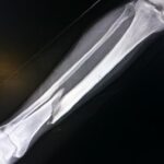 1bd4a57fd1de578cebe74d8f6dc4775c