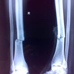 4e6d9c152c07e8190289186de3b1cad2