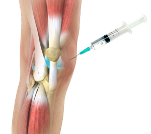 مرکز تزریق ژل زانو در شریعتی