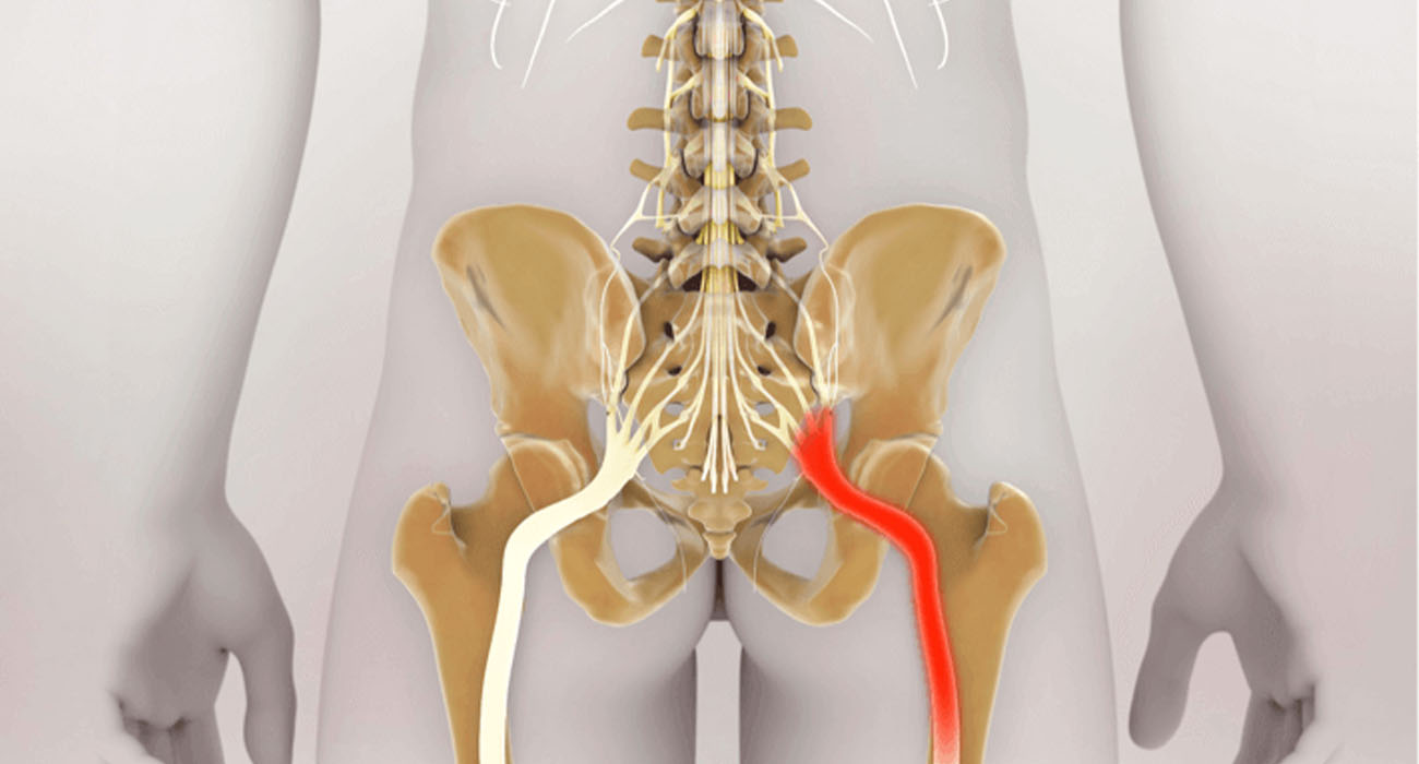 بهترین متخصص ارتوپد خانم برای زانو و لگن