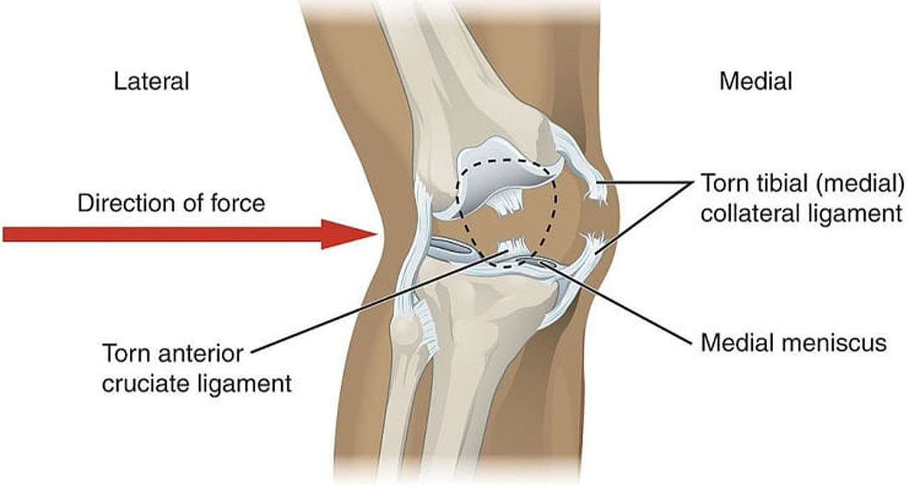 بهترین متخصص ارتوپد خانم برای زانو و لگن