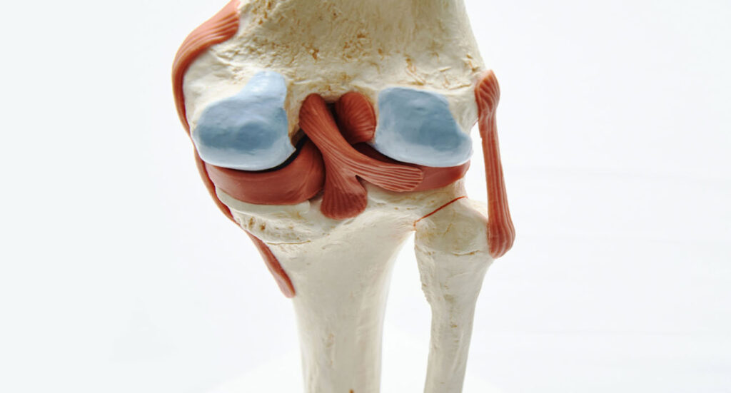 مرکز درمان پارگی مینیسک زانو