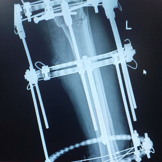 Untitlثقلذثصقلذقثل334d-1