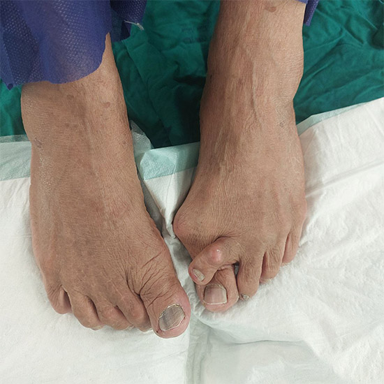 Untitlفد4ف5ثدتا4د4تد4ed-1