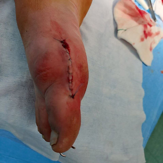 Untitlفذد435435ed-1