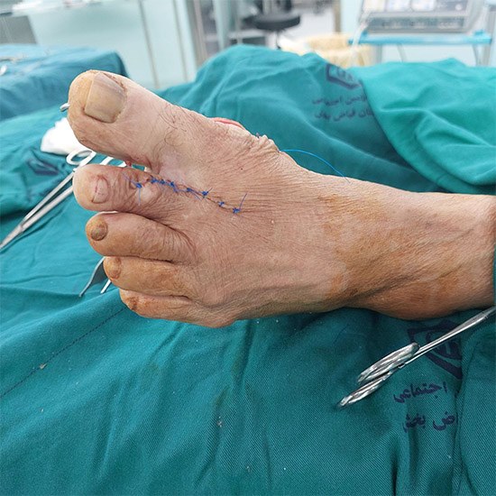 Untiفاقفتدقت4ت46ت4تد4tled-1